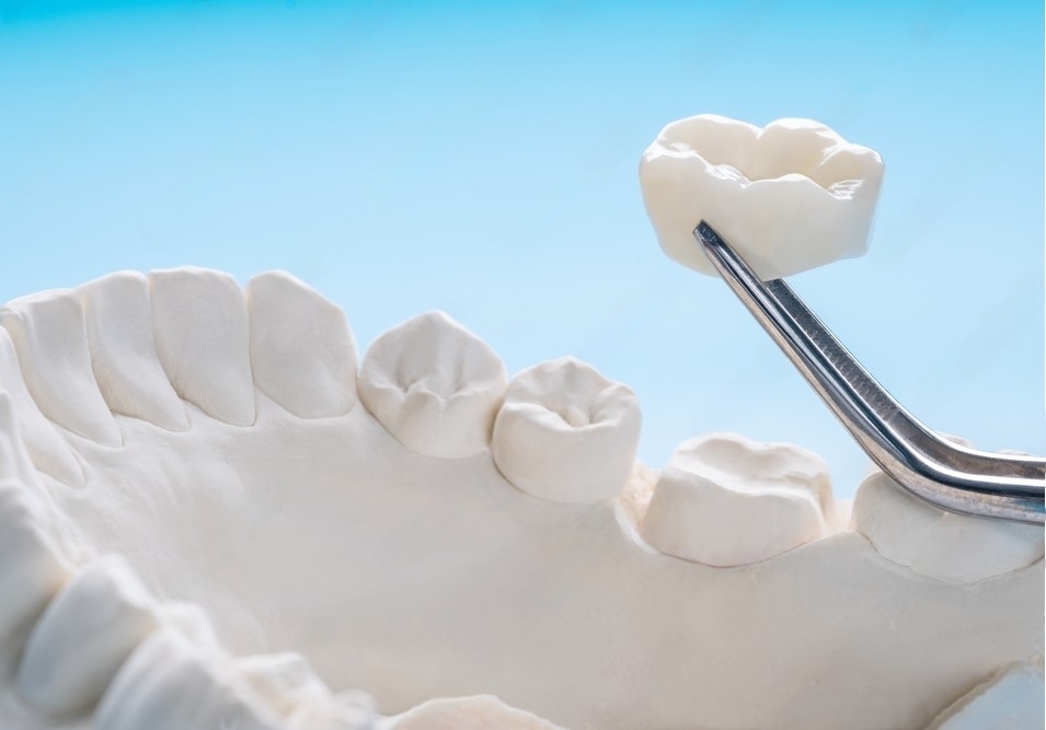 Cosmetic Dentistry